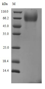 Spike glycoprotein (S), partial, Severe acute respiratory syndrome coronavirus 2, recombinant