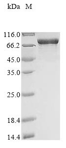 Myosin-6 (MYH6), partial, human, recombinant