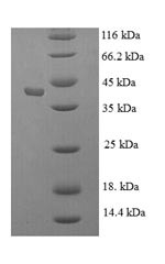 Kallikrein-1 (KLK1), human, recombinant