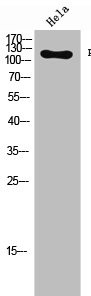 Anti-Phospho-FGFR1 (Y654)