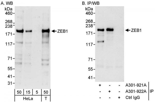 Anti-ZEB1