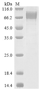 Interleukin-10 receptor subunit alpha (IL10RA), partial, human, recombinant