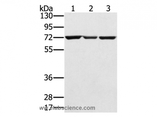 Anti-SLC25A13