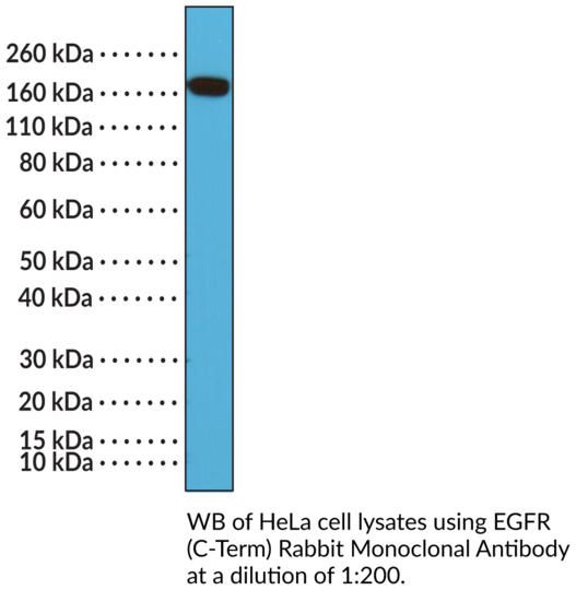 Anti-EGFR (C-Term) Rabbit Monoclonal Antibody (Clone RM294)