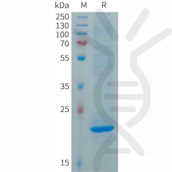 Human FGF19 Protein, His Tag