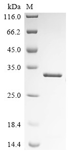 Histone deacetylase clr6 (clr6), partial, Schizosaccharomyces pombe, recombinant