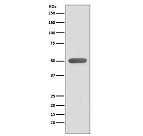 Anti-ESRRA / Estrogen-Related Receptor Alpha, clone EIO-5