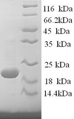 Interferon gamma (IFNG), sheep, recombinant