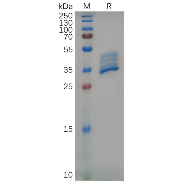 Mouse BCMA Protein, hFc Tag