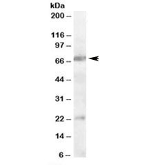 Anti-CHRNA4