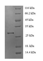 Acetylcholine receptor subunit alpha (Chrna1), partial, mouse, recombinant