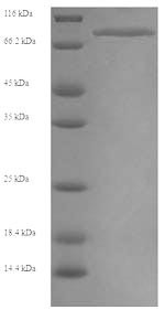 Myosin-6 (MYH6), partial, human, recombinant