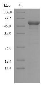 Glycogen synthase kinase-3 beta (GSK3B), human, recombinant