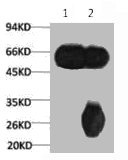 Anti-TUBB3 Monoclonal