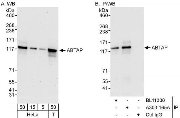 Anti-ABTAP