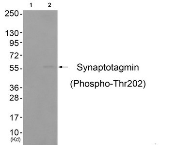 Anti-Phospho-SYT1 (Thr202)