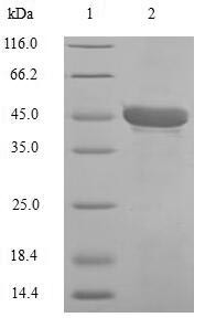 Carbonic anhydrase 1 (CA1), human, recombinant