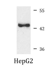 Anti-Cystathionase