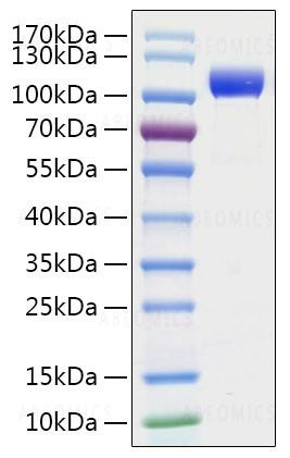 Recombinant SARS-CoV-2 Spike S1 Protein (His Tag)