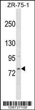 Anti-MICALCL, NT (MICALCL, MICAL C-terminal-like protein, ERK2-binding testicular protein 1, Ebitein