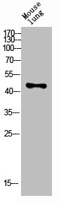 Anti-KIR3DL1