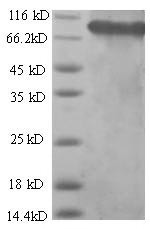 Succinate dehydrogenase [ubiquinone] flavoprotein subunit, mitochondrial (SDHA),partial, human, reco