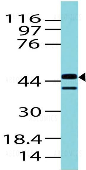 Anti-IDH1