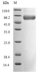 Spike glycoprotein (S), partial (Active), Severe acute respiratory syndrome coronavirus 2, recombina