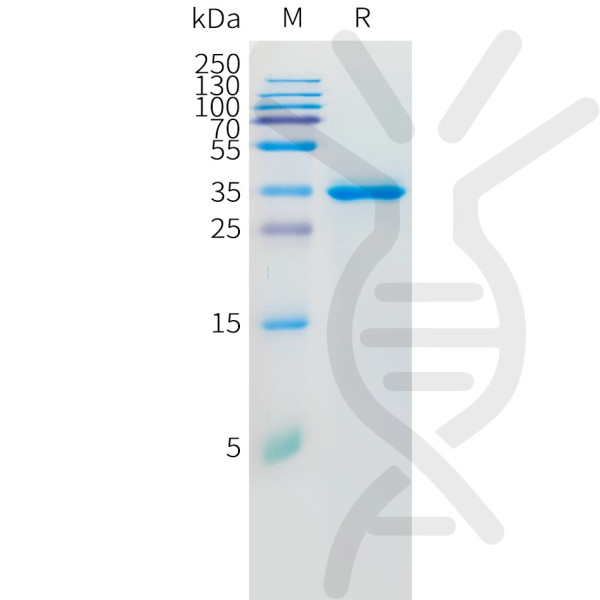 Human IL8 Protein, hFc Tag