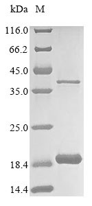 Acyl-CoA desaturase 1 (Scd1), partial, mouse, recombinant