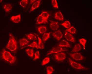 Anti-SM22 alpha / Transgelin