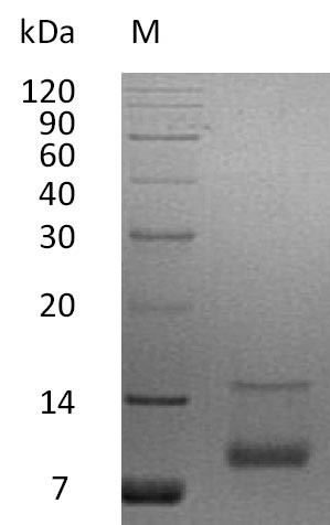 Insulin-like growth factor I (IGF1), partial (Active), human, recombinant