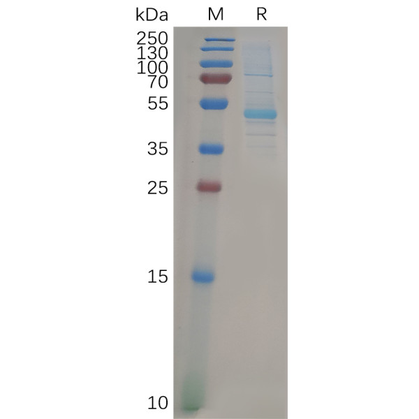 Human KRAS Protein, mFc Tag