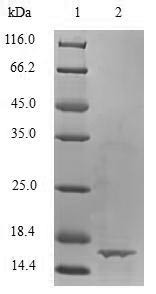 Transforming growth factor beta-1 proprotein (TGFB1), partial, bovine, recombinant