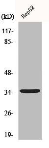 Anti-CD1E