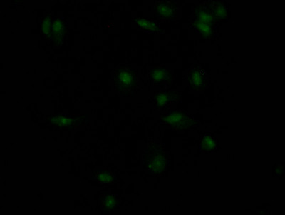 Anti-INSR Recombinant Monoclonal, clone 4B2