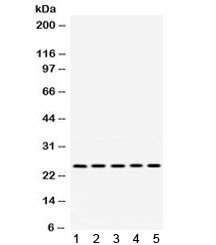 Anti-PGRMC1