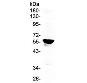 Anti-Aromatase / CYP19A1