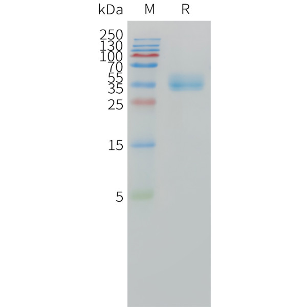 Human CA12 Protein, His Tag