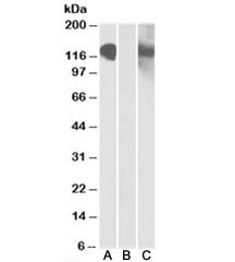 Anti-CDH11