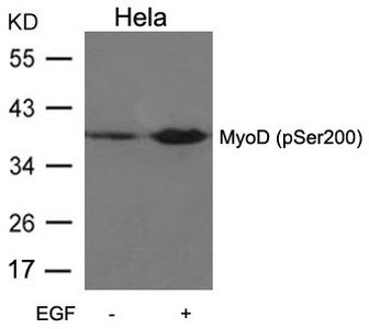 Anti-Phospho-MYOD1 (Ser200)