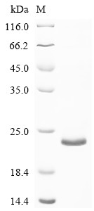 Transforming growth factor beta-1 (Tgfb1), partial, mouse, recombinant