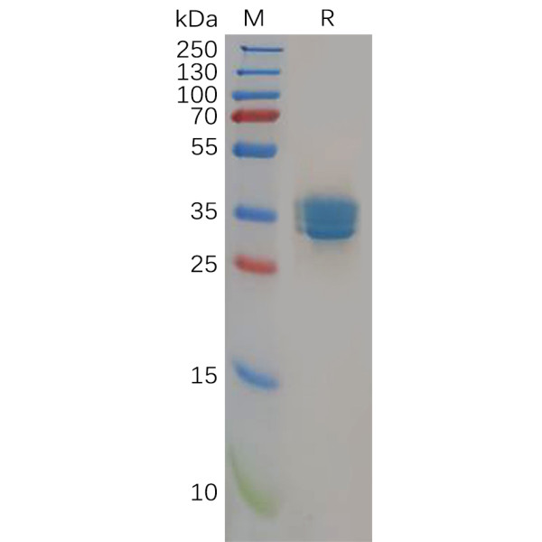 Human CB2 (1-33) Protein, hFc Tag