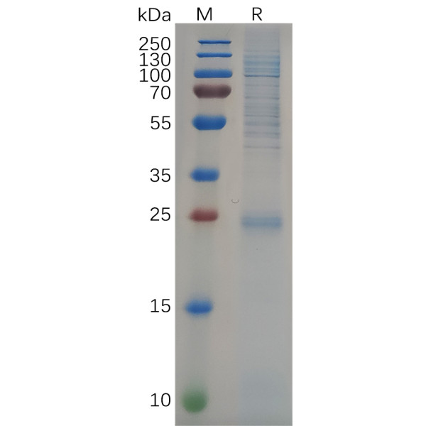 Human KRAS Protein, His Tag