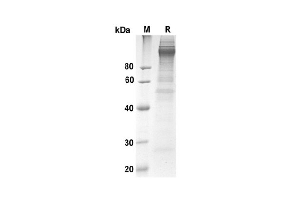 sCD163 Protein (His Tag) (recombinant human)