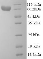 Alpha-L-iduronidase (IDUA), human, recombinant