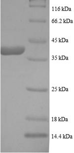 L-lactate dehydrogenase B chain (LDHB), human, recombinant