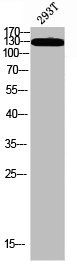 Anti-Phospho-IRS1 (S323)