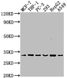 Anti-CD8A Recombinant Monoclonal, clone 2F2