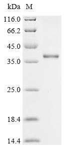 Histamine H1 receptor (Hrh1), partial, rat, recombinant